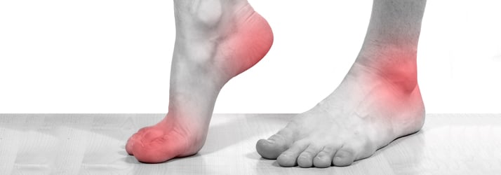 Podiatry Lawrenceville NJ Neuromas